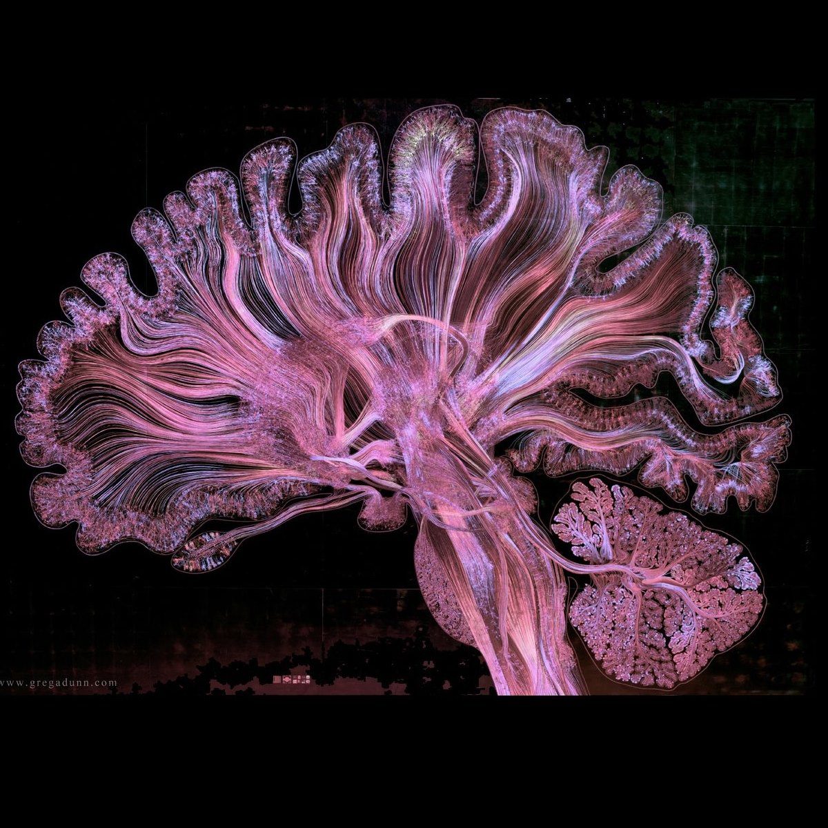 zdjęcie przekroju mózgu
