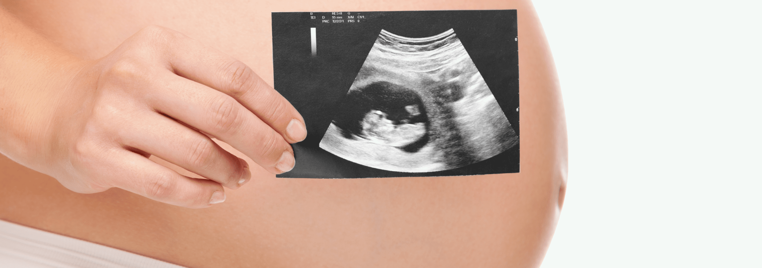 kobieta w ciąży trzyma zdjęcie z USG