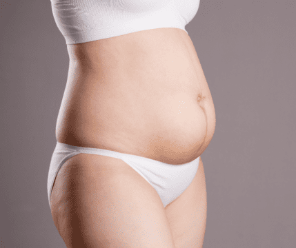 brzuch po ciąży, zdjęcie w bieliźnie od szyi do ud